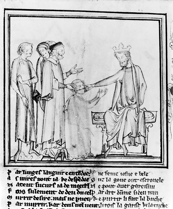 Edward the confessor touching for the evil